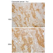 Solarbio K110085P Anti-PTHLH Polyclonal Antibody