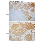 Solarbio K110324P Anti-PROKR1 Polyclonal Antibody