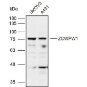 Solarbio K110094P Anti-ZCWPW1 Polyclonal Antibody