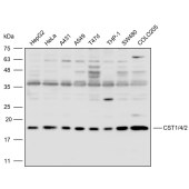 Solarbio K110483P Anti-CST1/4/2 Polyclonal Antibody