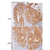 Solarbio K112161P Anti-PNPLA6 Polyclonal Antibody