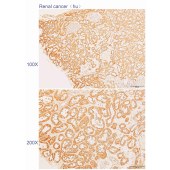 Solarbio K110284P Anti-CLTC Polyclonal Antibody