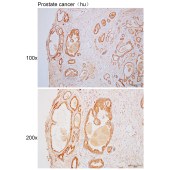 Solarbio K110391P Anti-UFL1 Polyclonal Antibody