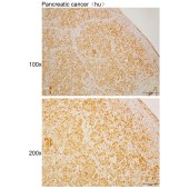 Solarbio K110489P Anti-ZNF267 Polyclonal Antibody
