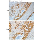 Solarbio K112229P Anti-TBC1D9B Polyclonal Antibody