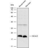 Solarbio K110367P Anti-NCALD Polyclonal Antibody