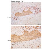 Solarbio K110371P Anti-STK38 Polyclonal Antibody