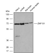 Solarbio K009820P Anti-ZNF131 Polyclonal Antibody