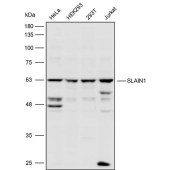 Solarbio K110525P Anti-SLAIN1 Polyclonal Antibody