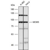 Solarbio K110067P Anti-MCM5 Polyclonal Antibody