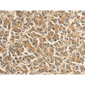 Solarbio K009869P Anti-FARS2 Polyclonal Antibody