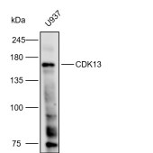 Solarbio K112273P Anti-CDK13 Polyclonal Antibody