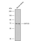 Solarbio K009854P Anti-GSTCD Polyclonal Antibody