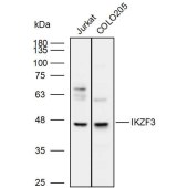 Solarbio K110007P Anti-IKZF3 Polyclonal Antibody