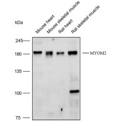 Solarbio K112201P Anti-MYOM2 Polyclonal Antibody