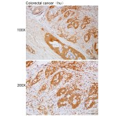 Solarbio K112252P Anti-TIPRL Polyclonal Antibody