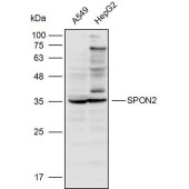 Solarbio K110302P Anti-SPON2 Polyclonal Antibody