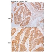 Solarbio K110382P Anti-RUFY1 Polyclonal Antibody