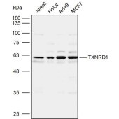 Solarbio K110129P Anti-TXNRD1 Polyclonal Antibody