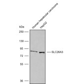 Solarbio K009844P Anti-SLC26A3 Polyclonal Antibody
