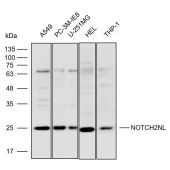 Solarbio K112294P Anti-NOTCH2NL Polyclonal Antibody