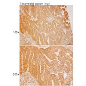 Solarbio K112206P Anti-MRC2 Polyclonal Antibody