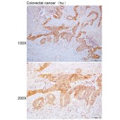 Solarbio K110345P Anti-KRT20 Polyclonal Antibody