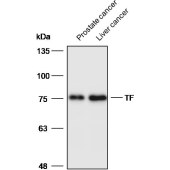 Solarbio K200079M Anti-TF Monoclonal Antibody