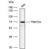 Solarbio K110071P Anti-TRMT2A Polyclonal Antibody