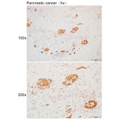 Solarbio K110287P Anti-ADRA2 Polyclonal Antibody