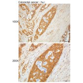Solarbio K112236P Anti-TSPO Polyclonal Antibody