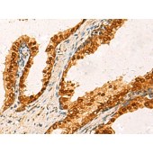 Solarbio K009862P Anti-CMAS Polyclonal Antibody