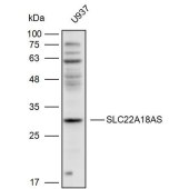 Solarbio K110338P Anti-SLC22A18AS Polyclonal Antibody