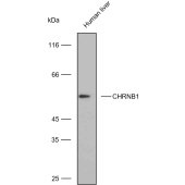 Solarbio K009782P Anti-CHRNB1 Polyclonal Antibody