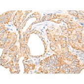 Solarbio K009832P Anti-CORO7 Polyclonal Antibody
