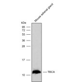 Solarbio K009812P Anti-TBCA Polyclonal Antibody