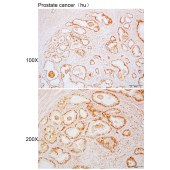Solarbio K110001P Anti-RAD9A Polyclonal Antibody