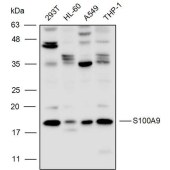 Solarbio K110286P Anti-S100A9 Polyclonal Antibody