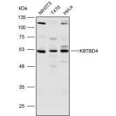 Solarbio K109998P Anti-KBTBD4 Polyclonal Antibody