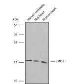 Solarbio K009846P Anti-LMO3 Polyclonal Antibody