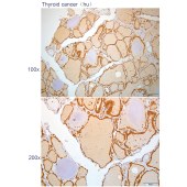 Solarbio K112244P Anti-CTHRC1 Polyclonal Antibody