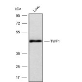 Solarbio K009801P Anti-TWF1 Polyclonal Antibody