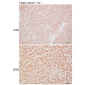Solarbio K110053P Anti-ZBED8 Polyclonal Antibody
