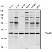 Solarbio K110315P Anti-RRAGC Polyclonal Antibody