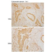 Solarbio K110048P Anti-TM9SF1 Polyclonal Antibody