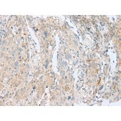 Solarbio K009844P Anti-SLC26A3 Polyclonal Antibody