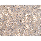 Solarbio K009821P Anti-VTI1B Polyclonal Antibody