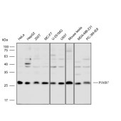 Solarbio K112286P Anti-PSMB7 Polyclonal Antibody