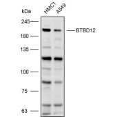 Solarbio K110400P Anti-BTBD12 Polyclonal Antibody