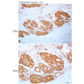 Solarbio K112235P Anti-IMPA1 Polyclonal Antibody